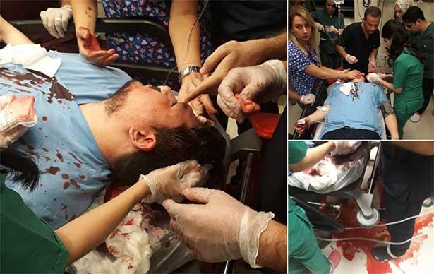SON DAKİKA! Doktora vahşi saldırı! Kaldırım taşıyla başına vurulan doktor yoğun bakımda!