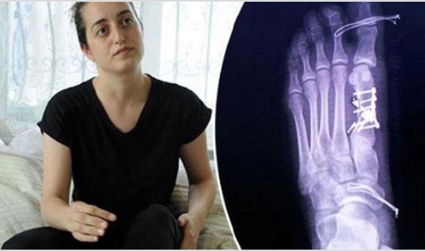 Yanlış parmağı ameliyat ettiği öne sürülen doktor açığa alındı