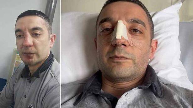 Acil serviste darbedilen güvenlik görevlisi: Hiçbir suçum yoktu