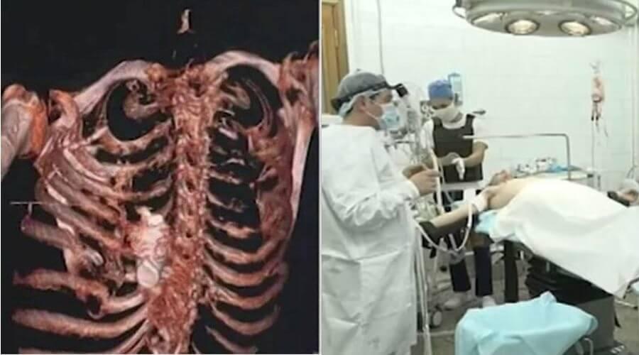 Tıp dünyasını şaşkına çeviren vaka! Patlasaydı doktorlar da ölürdü