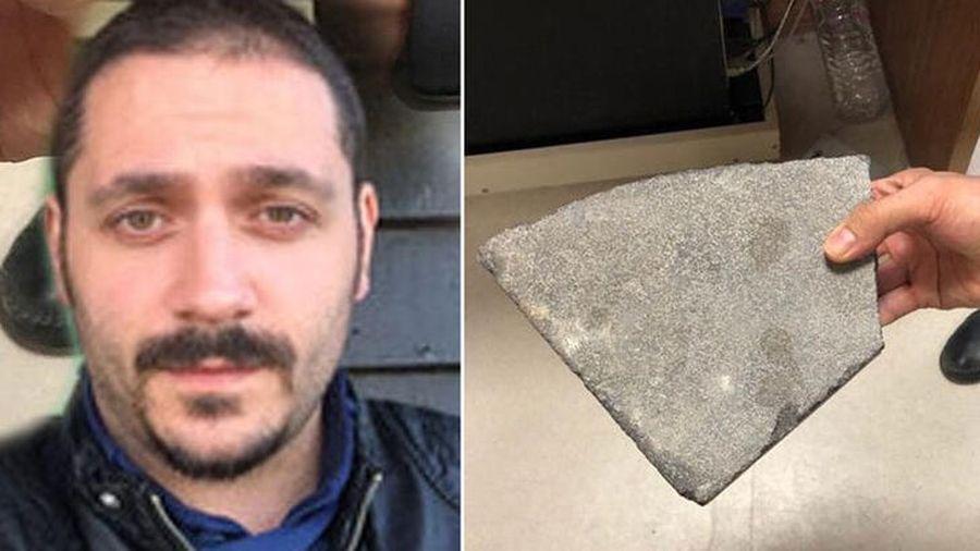 Serbest kalır kalmaz yine acili bastı! Doktora kaldırım taşıyla saldıran zanlı tutuklandı