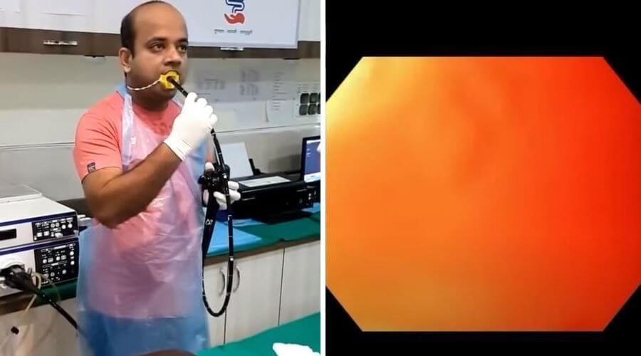 Kendi kendine endoskopi yapan doktor sosyal medyayı salladı