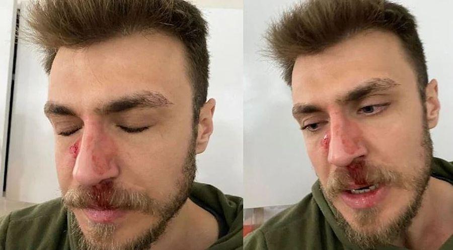 ‘Kadın doğum doktoru niye erkek’ dedi, asistan hekimi darbetti