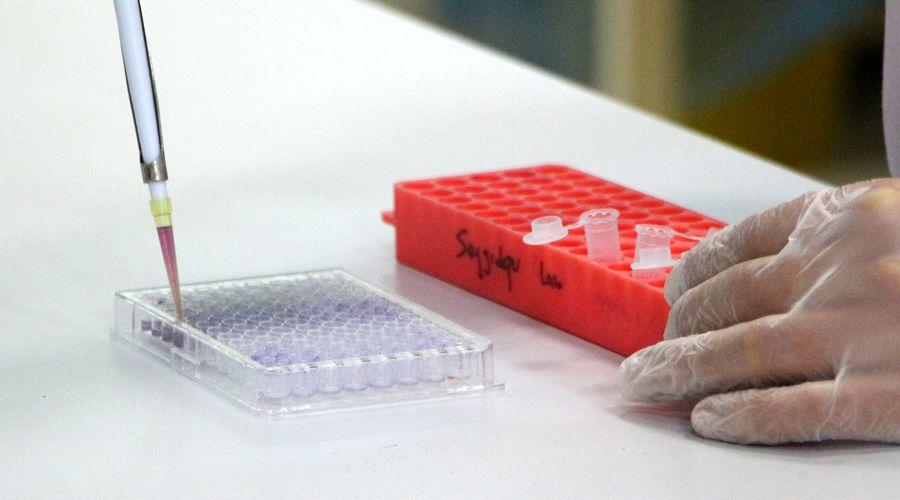 COVID-19'un bir etkisi daha ortaya çıktı: Kanseri hızlandırıyor