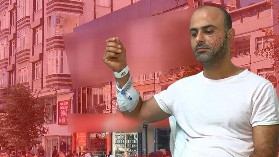 Lazer epilasyon sonrası 'yanık' suçlaması! 'Bize şeker hastası olduğunu söylemedi'