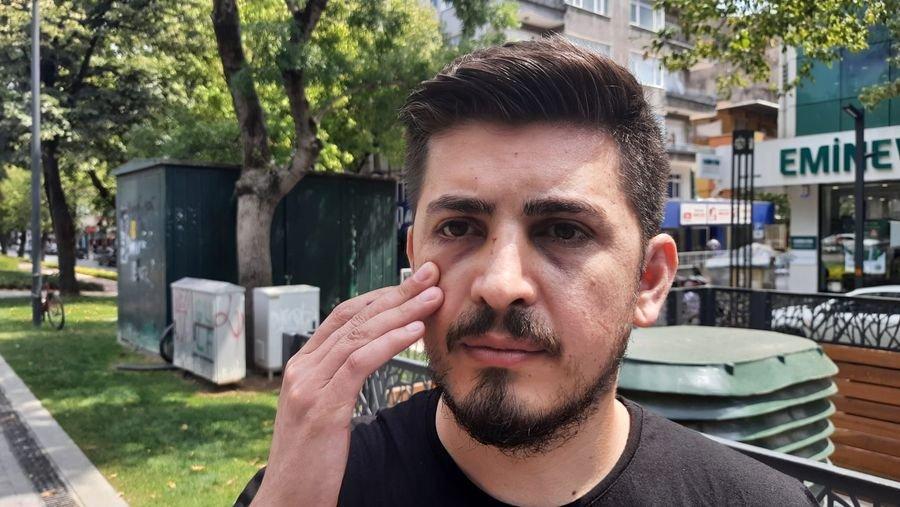 Hemşirenin burnunu kırdı, adli kontrolle serbest kaldı