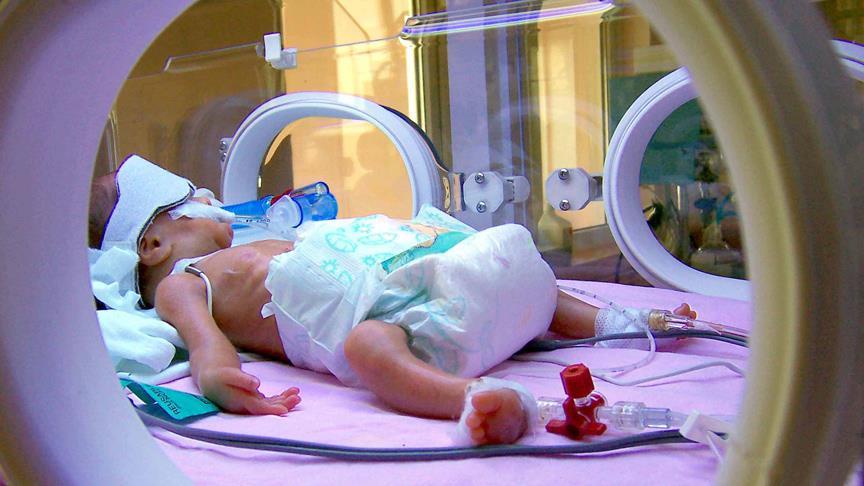 Türkiye'de prematüre doğum oranı artıyor