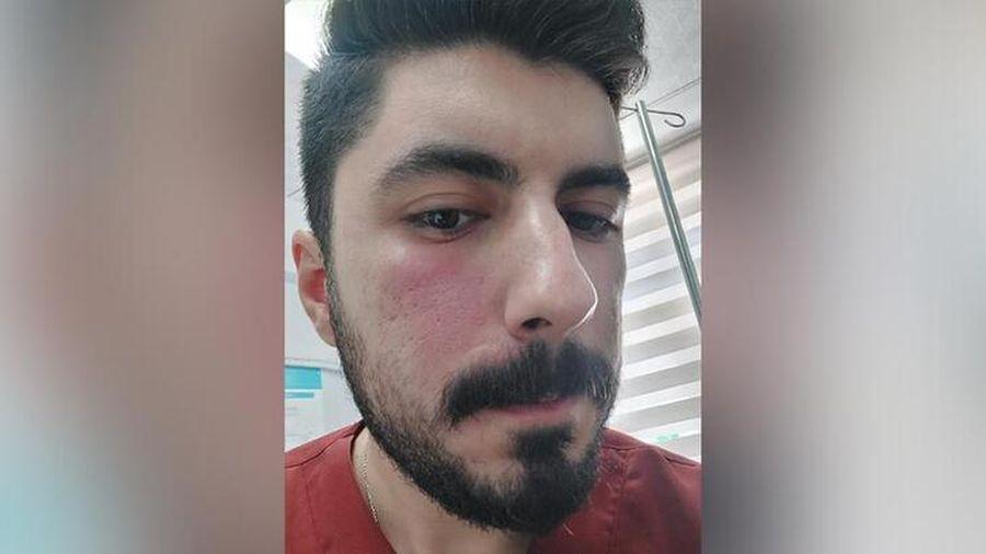 Yer yine Şanlıurfa: Sağlık çalışanlarını darbeden kişi gözaltına alındı