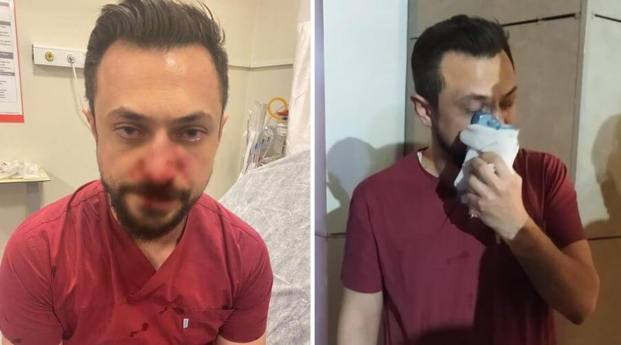 Şanlıurfa'da saldırıya uğrayan doktorun burnu kırıldı