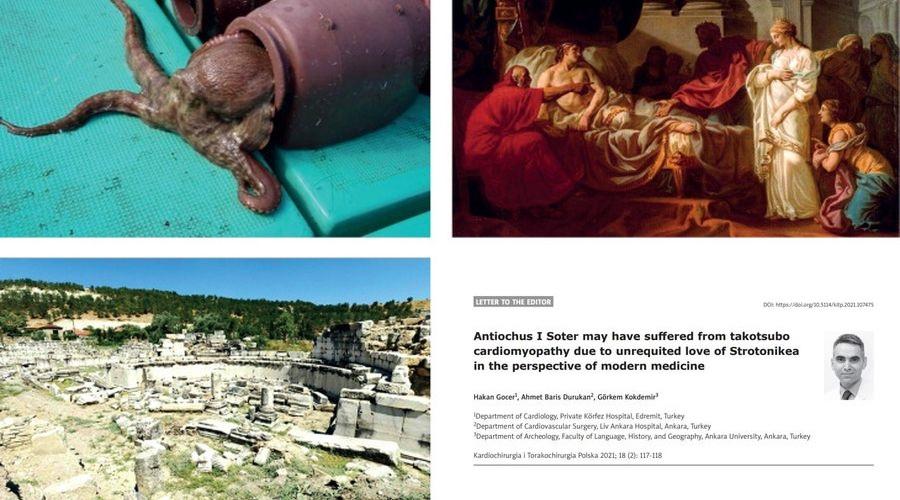 Üç Türk bilim insanından ilgi çekici araştırma: Tarihteki ilk Takotsubo kardiyomiyopatisi