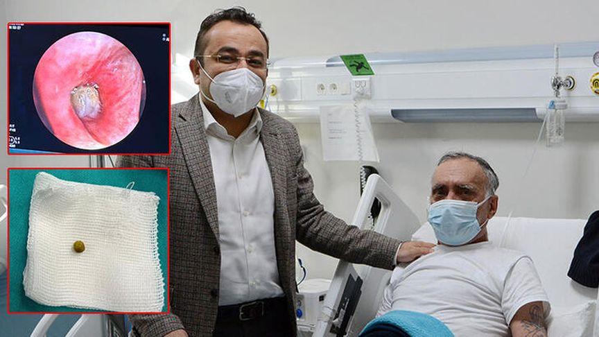 Akciğere kaçan bezelye ameliyatla çıkarıldı