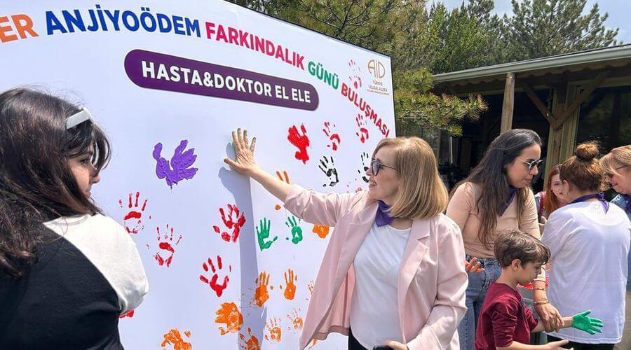 10 bin kişide 1 görülüyor, tanısı 20 yıl sonra konulan hastalar var
