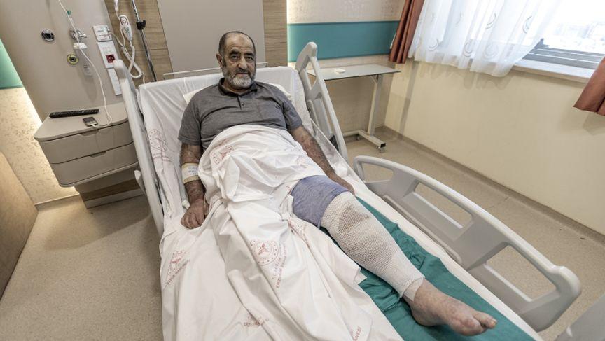 Ağrıyan bacaklarına ısırgan otu sardı, ikinci derece yanık oldu