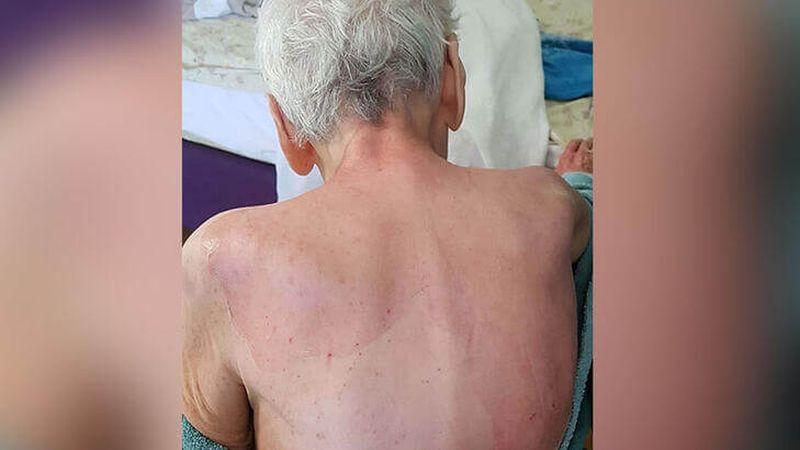 Bakımevinde şüpheli ölüm: Nadir hastalık denildi, Adli Tıp raporu çalışanları yalanladı