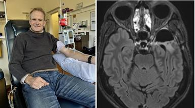 Beyin kanserine yakalanan onkolog, kendi çalışmasıyla kanseri yendi