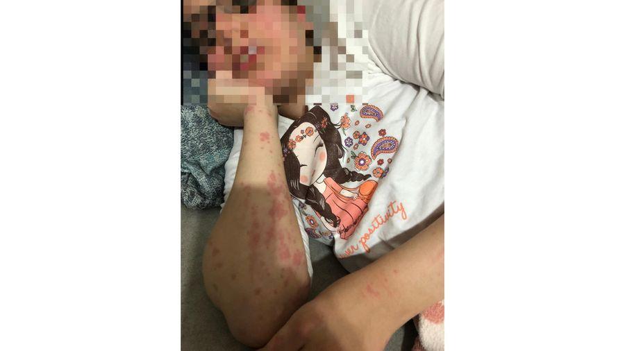 Eczacının verdiği muadil ilaç alerjik etki yaptı; baba şikayetçi oldu