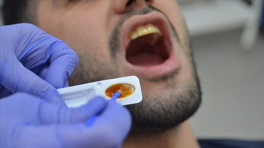 Diş hassasiyeti olanlar için florsuz vernik geliştirildi