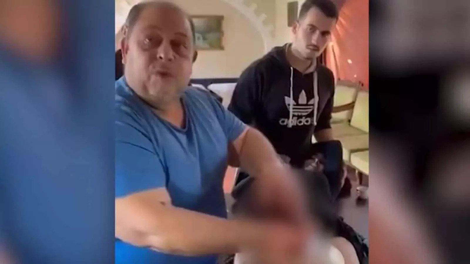 Gazze'deki doktor, yeğeninin bacağını anestezi olmadan ampüte etti