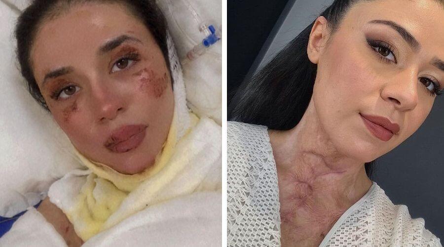 Acil serviste dehşet: Çakmak çakıp ‘Yakayım mı sizi’ diye sordu