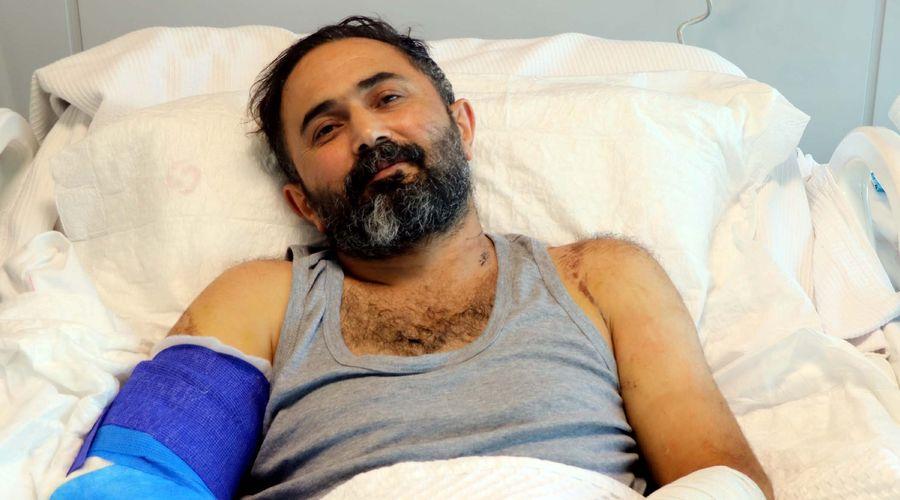 İş kazasında makineye sıkışan kolları mikrocerrahi ile kesilmekten kurtarıldı