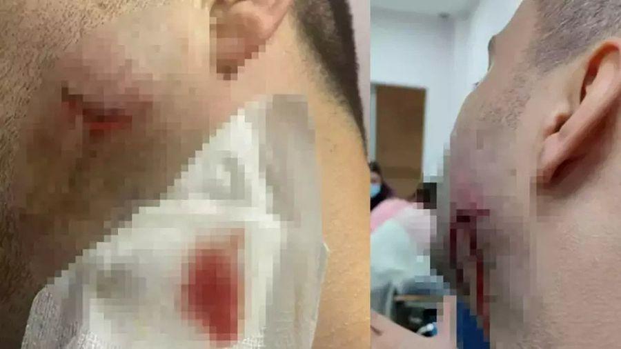 Sağlık personelini darbedip ısıran jandarma açığa alındı!
