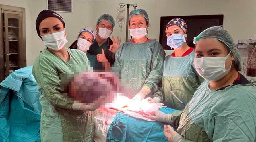 Karın şişliği için gitti, vücudundan 20 kiloluk kitle çıkarıldı