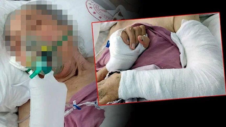 'Yoğun bakımda hastanın kolu kırıldı' iddiasına soruşturma
