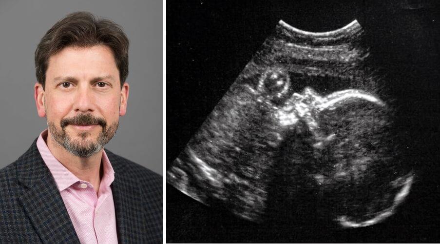 Doktorlar ilk rahim içi beyin ameliyatında başarılı oldu!