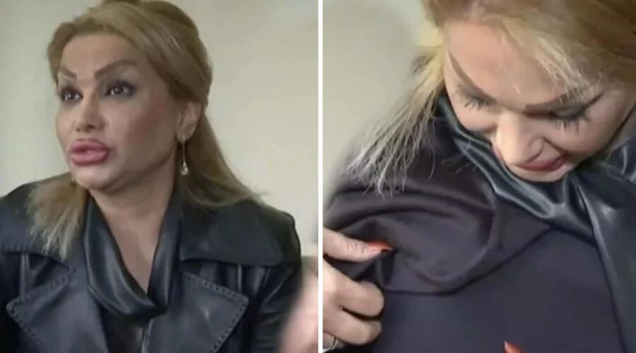 Estetik ameliyatı sonrası memelerini kaybeden kadından 'sahte doktor' iddiası