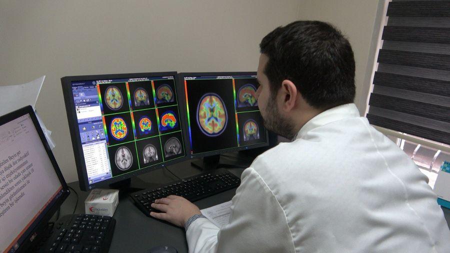 Trabzon’da Alzheimer hastalarında yeni tanı yöntemi!