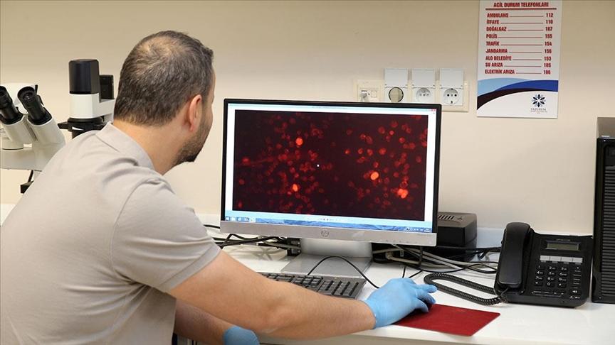 Akademisyenler, Alzheimer hastalığını kan tahliliyle erken teşhis için çalışıyor
