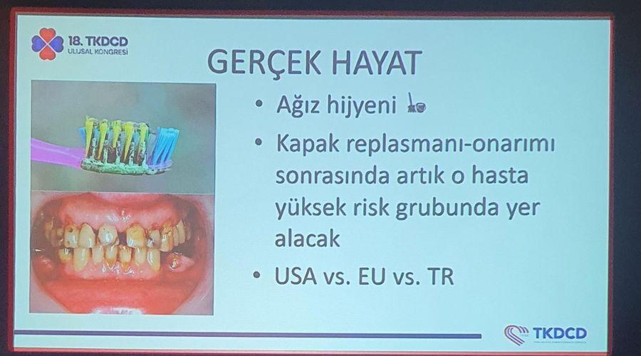 Bilimsel sunumda ortaya çıktı: 6 kişilik ailenin tamamı aynı diş fırçasını kullandı