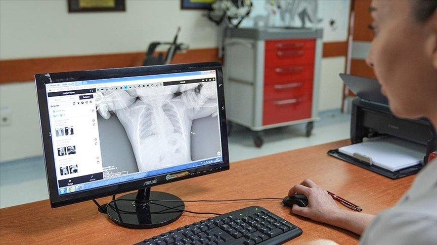 Çengelli iğne yutan 10 aylık bebek zamanında müdahaleyle kurtarıldı