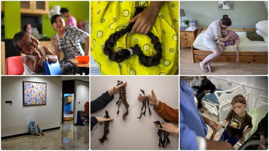 Dünyada her yıl yaklaşık 400 bin çocuk kansere yakalanıyor