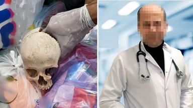 Sitenin çöpünden çıkan kafatasının sırrı çözüldü! Uzman doktor gözaltına alındı