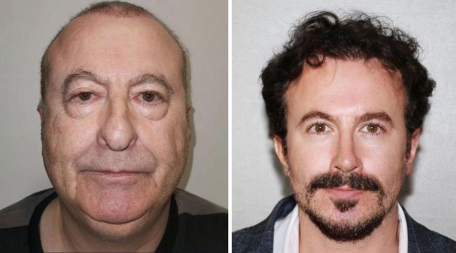 Dünya onu konuşuyor: Türkiye'ye gelip 30 yaş gençleşen adam