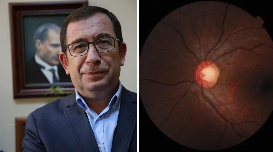 Glokom hastalığında erken teşhis kör olmayı önlüyor