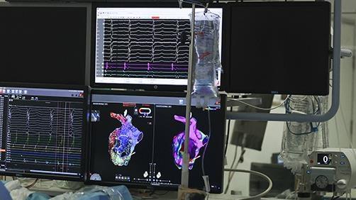 Kalbin 3 boyutlu haritasıyla belirlenen 'küçük beyni' kalp hastalıklarına çare olacak