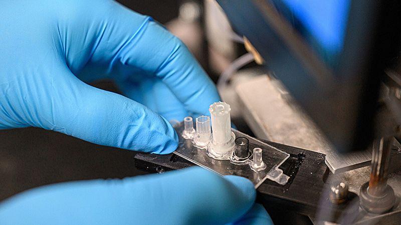 Araştırmacılar glioblastoma için uygun fiyatlı ve hızlı kan testi geliştirdi