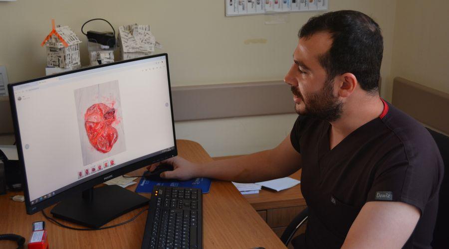 Karın şişliği için hastaneye gitti, böbreğinden 23 santimetrelik kist çıkarıldı