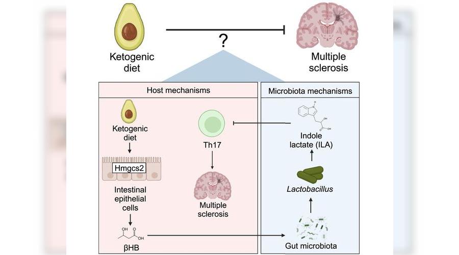 Keto diyeti, otoimmün bozuklukların tedavisinde umut vaadediyor