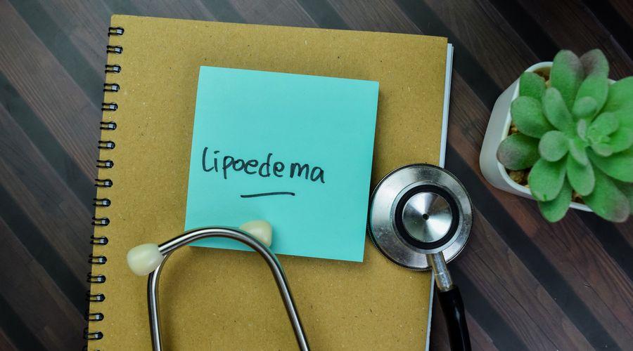 Lipödem nedir? Tedavisi var mı?