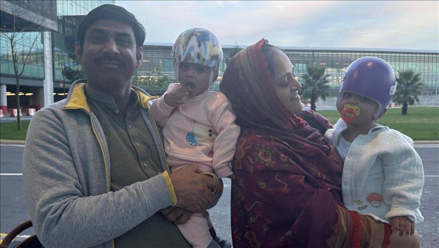 Türkiye'de 14 saatlik operasyonla ayrılan Pakistanlı yapışık ikizler taburcu edildi