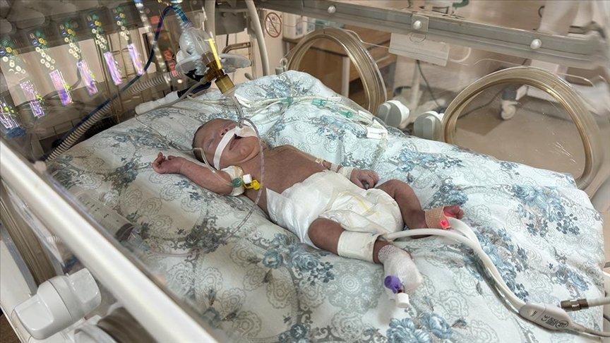Balıkesir'de prematüre doğan bebek İstanbul'dan gelen kalp cerrahının operasyonuyla sağlığına kavuştu