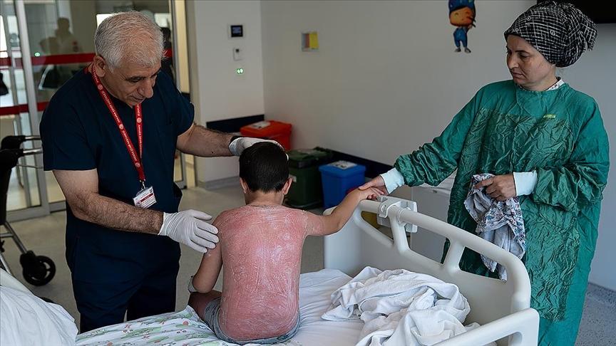 Güneşte 4 saat kalan çocuk, ikinci derece yanıkla hastanelik oldu