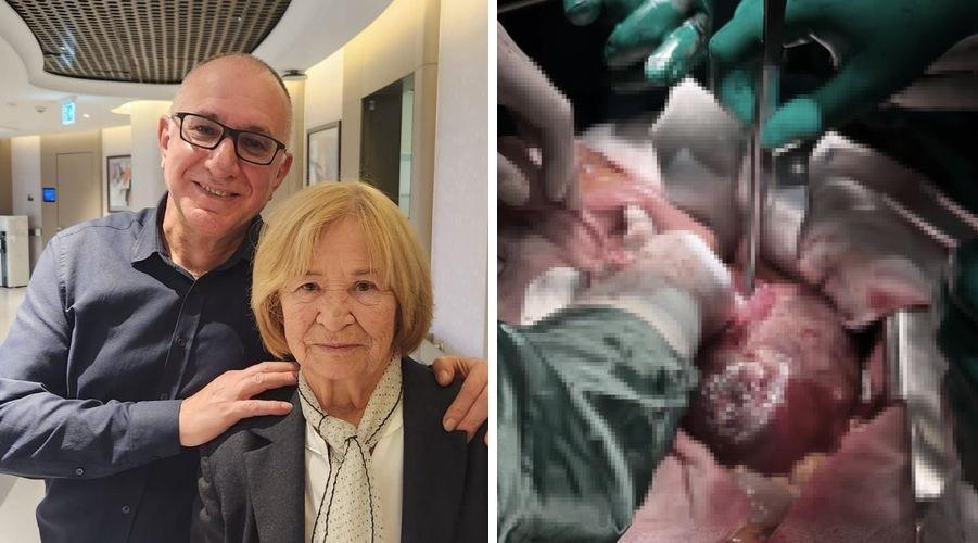 Dev pıhtı bloku hastanın karnından çıkarıldı: 'Öğrencilerime sorsam bu vakaya inanmazlar'