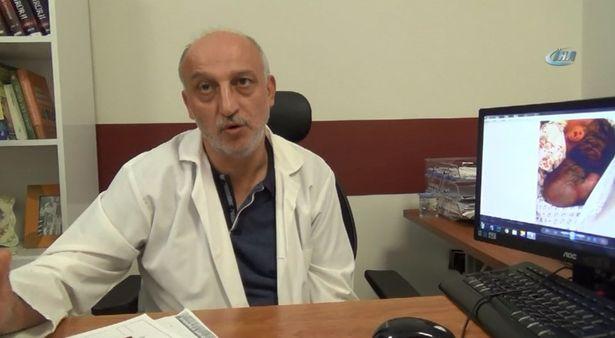 5 binde 1 görülüyor... Hatay'da ameliyata alındı 