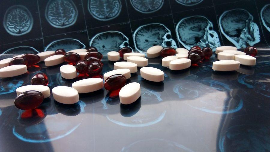 Alzheimer'a karşı yeni ilaç: Tedavide dönüm noktası olabilir