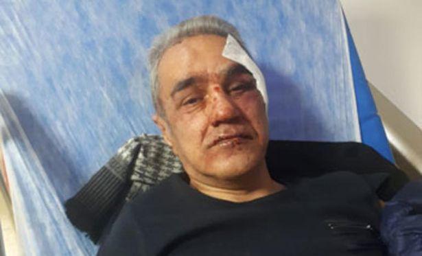 Beyin kanaması geçiren doktora saldıran kişi serbest bırakıldı