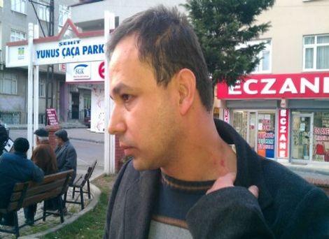 Bir darp haberi de İstanbul'dan!